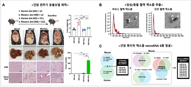 AI가 밝힌 간암 조기진단의 열쇠…국내 연구진, 혈액검사로 95% 정확도 달성