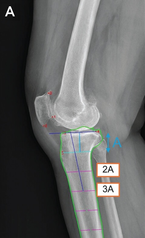  무릎 엑스레이로 2.5초 만에 진단…서울대, 인공지능 진단기술 개발