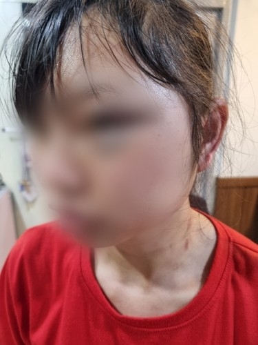 베트남 여성 노동자 폭행한 간부에 징역 2년 구형…외국인 인권 보호 촉구