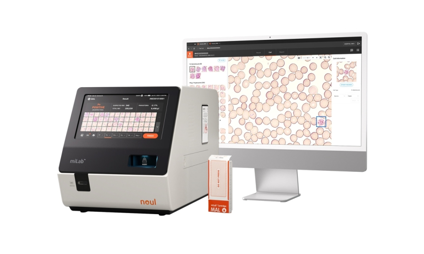  AI로 말라리아 잡는다…노을, 국제학회서 진단 정확도 98% 성과 발표