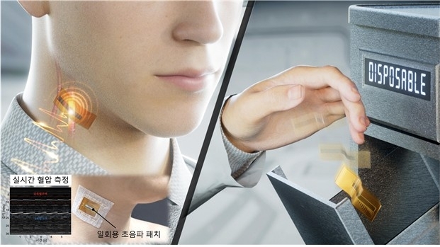 납 없는 초음파 의료기기 등장…실리콘 기반으로 가격·환경 문제 잡았다